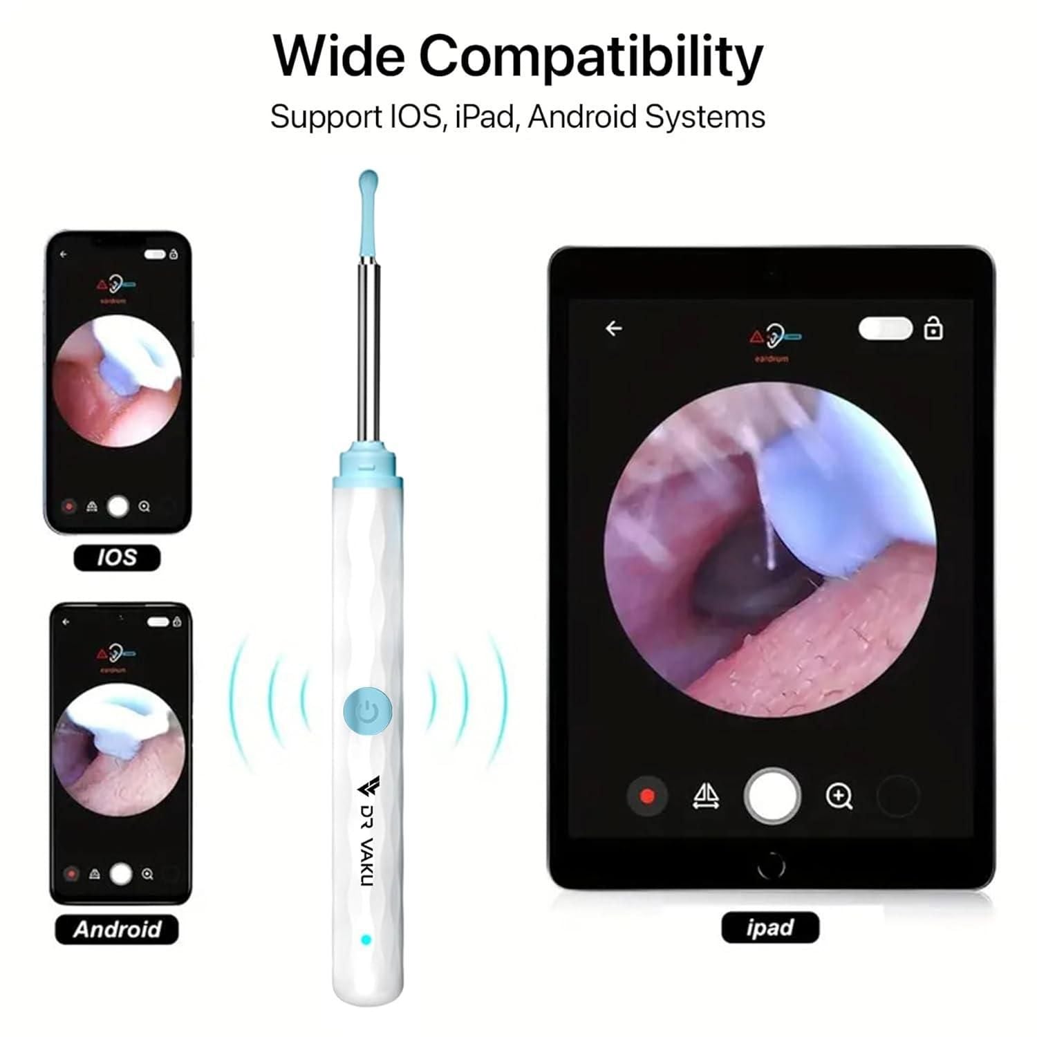 Smart Visual Ear Wax Cleaner – Safe & Precise Ear Cleaning