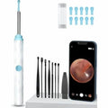 Smart Visual Ear Wax Cleaner – Safe & Precise Ear Cleaning