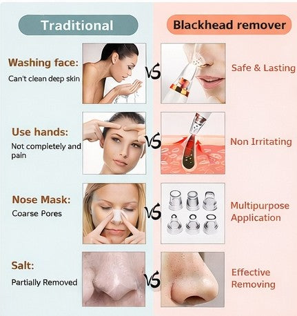 Electric Blackhead Remover – Deep Pore Cleansing at Home