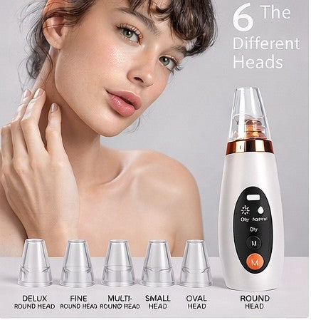 Electric Blackhead Remover – Deep Pore Cleansing at Home