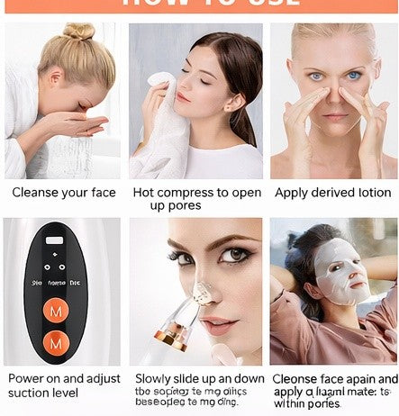 Electric Blackhead Remover – Deep Pore Cleansing at Home